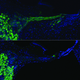 The top image shows auditory nerves regrown by the new therapy.